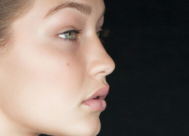 Turbinate Reduction Surgery