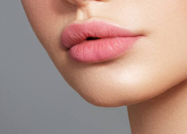 Lip Lift & Lip Fillers