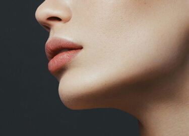 Jawline Filler – Chin Augmentation