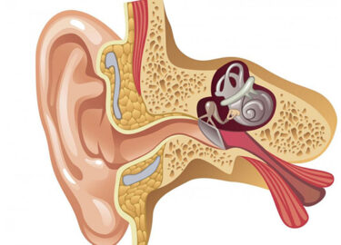 Ear Tube Surgery