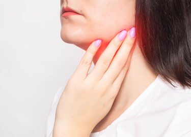 Salivary Gland Stone