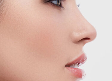 How is a Big and Long Nose Aesthetic Performed?