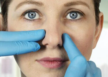 How is Wide Rhinoplasty Performed?