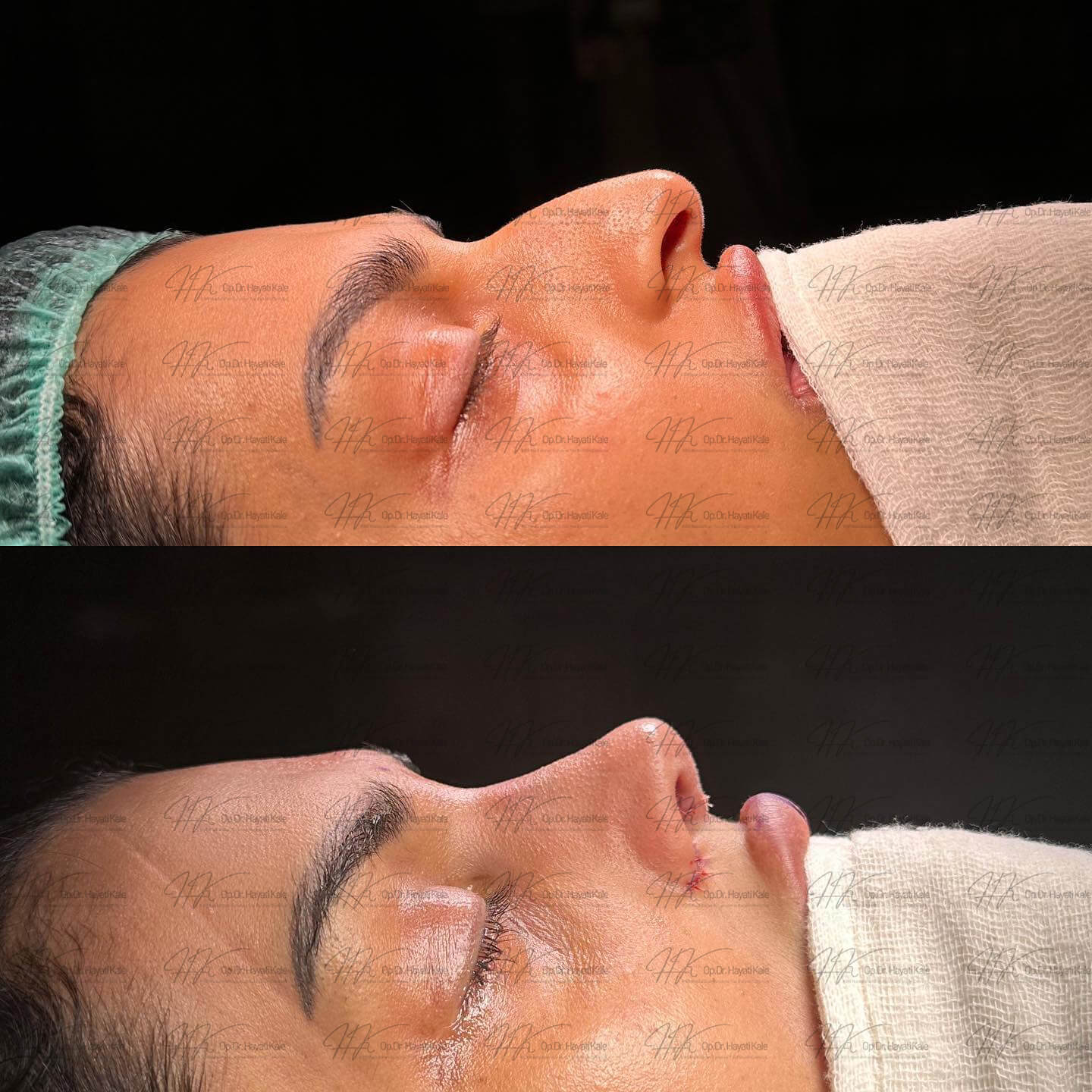 before-after