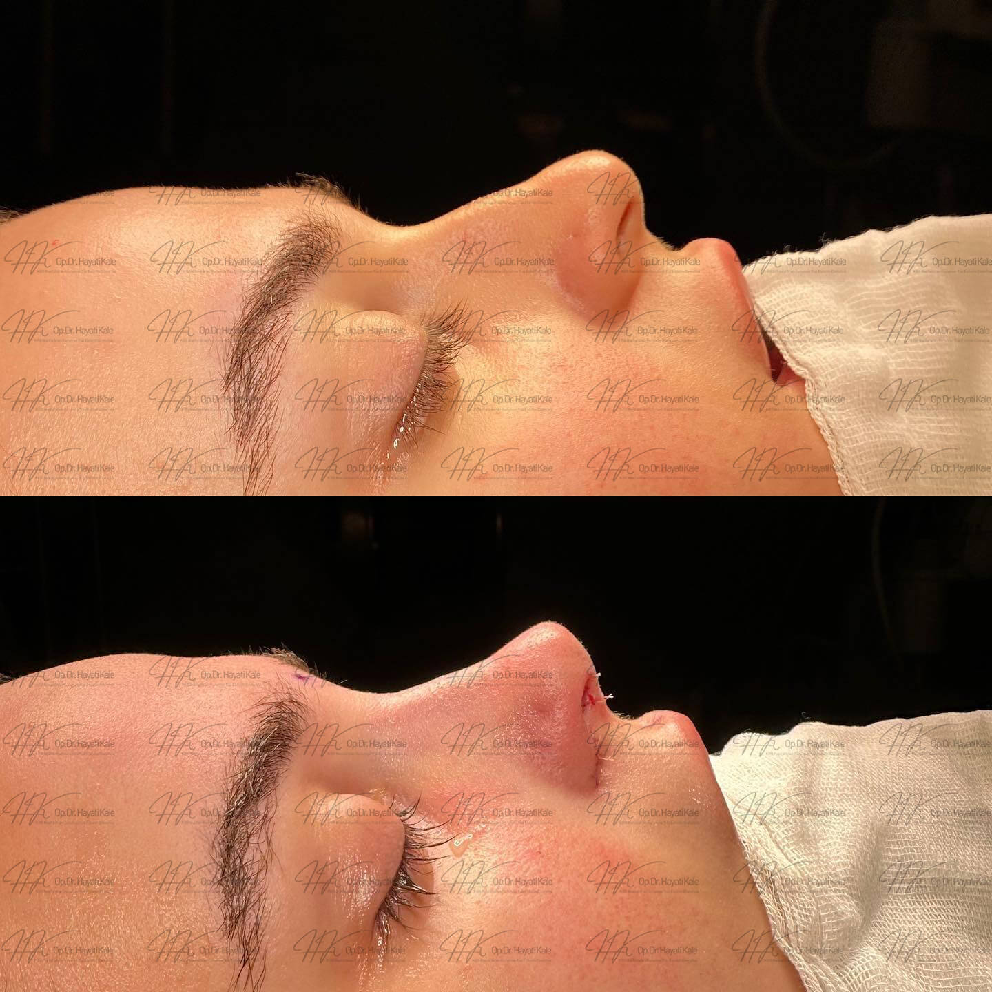 before-after