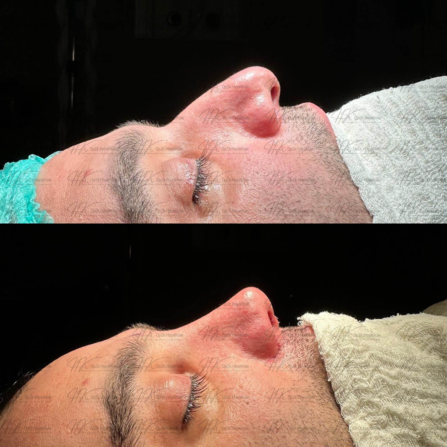 before-after