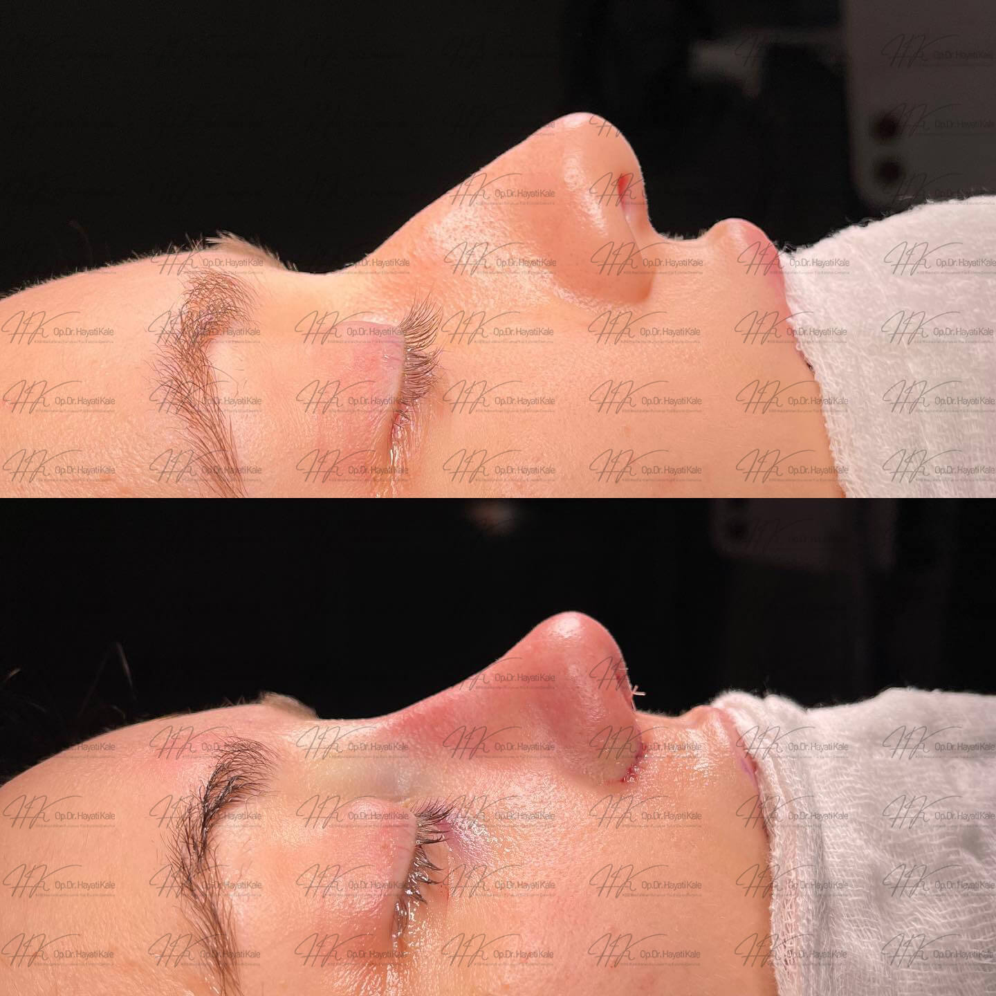 before-after
