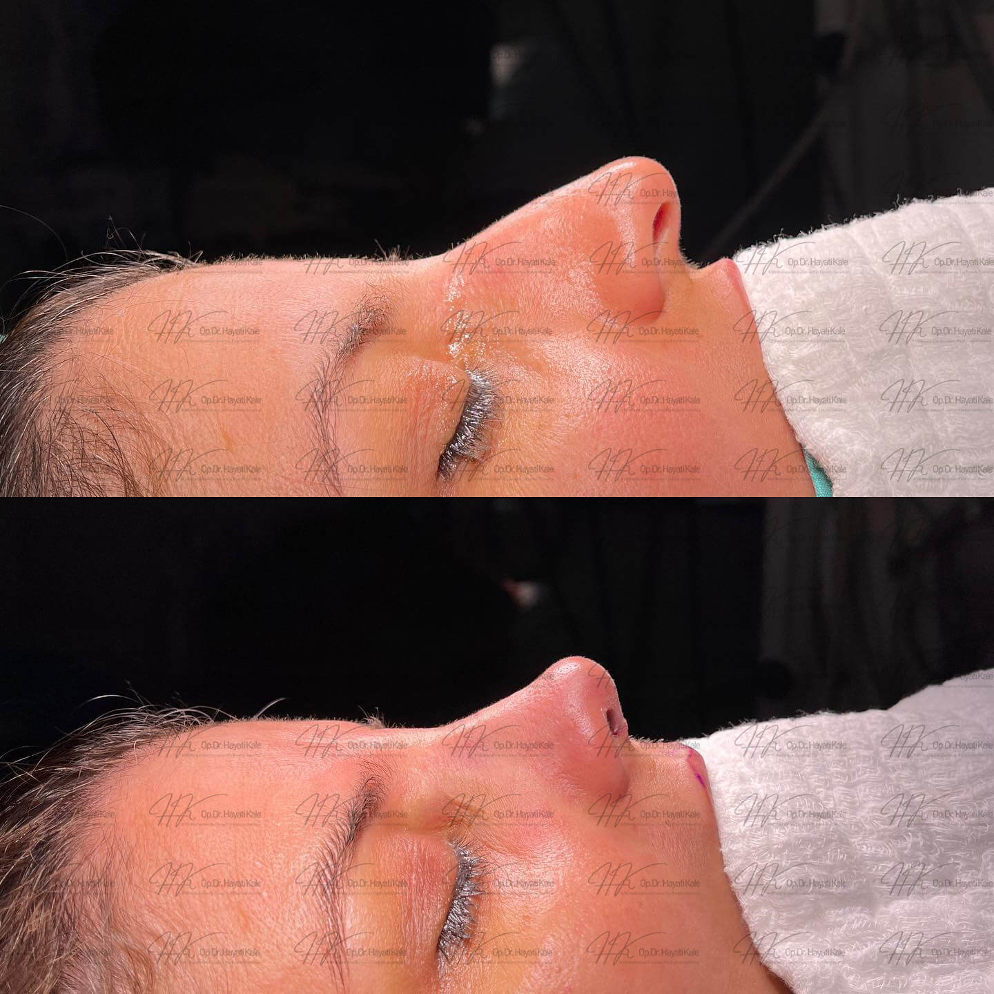 before-after
