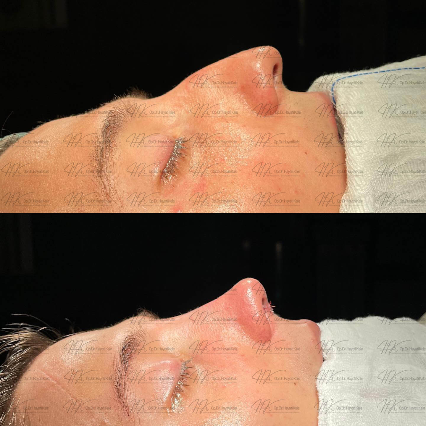 before-after
