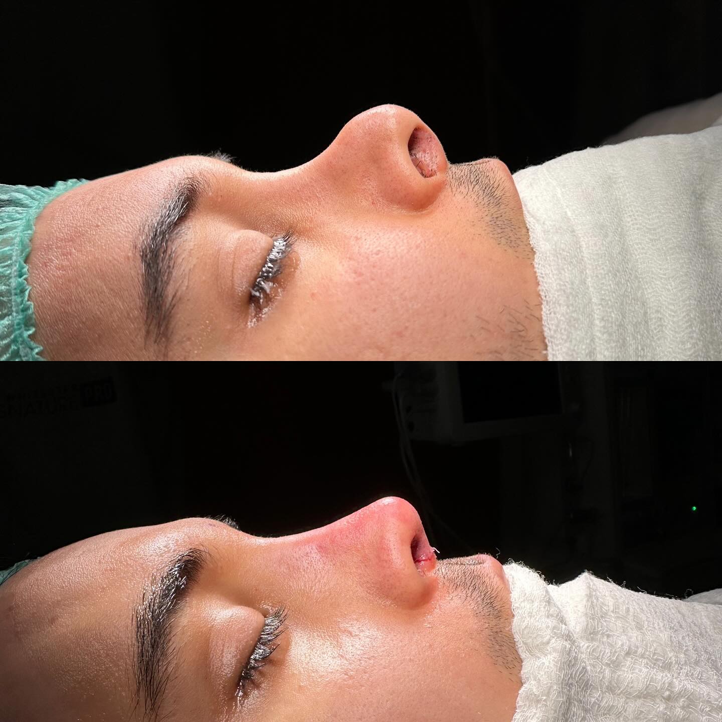 before-after
