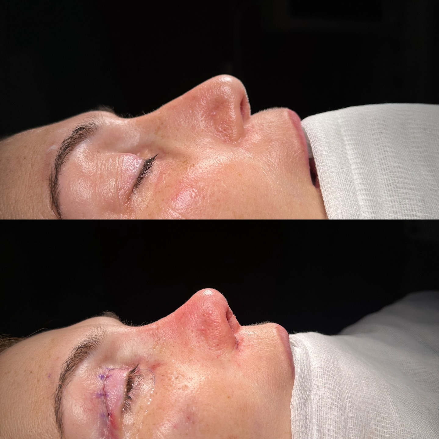 before-after