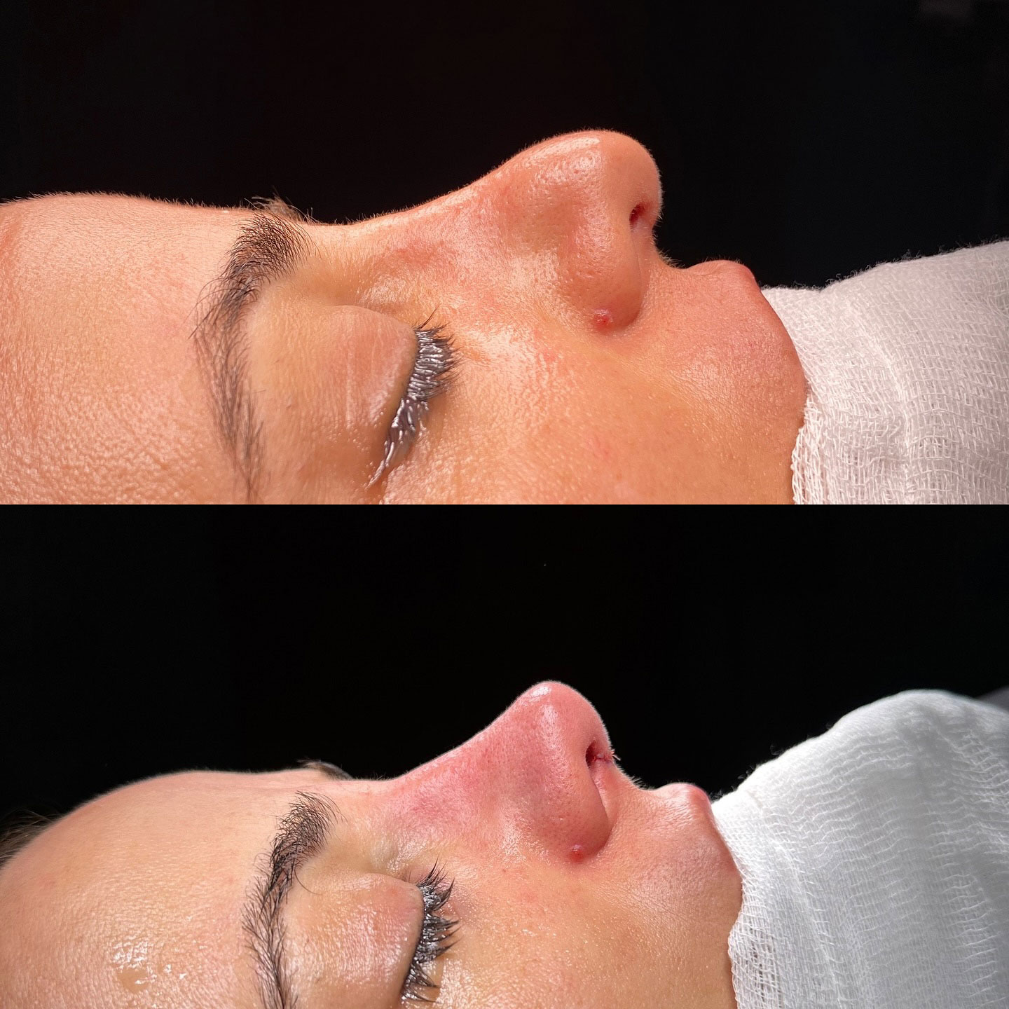 before-after