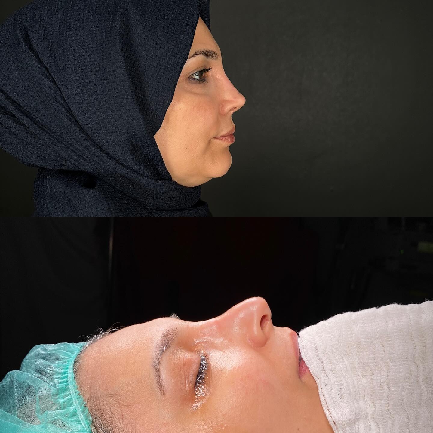 before-after