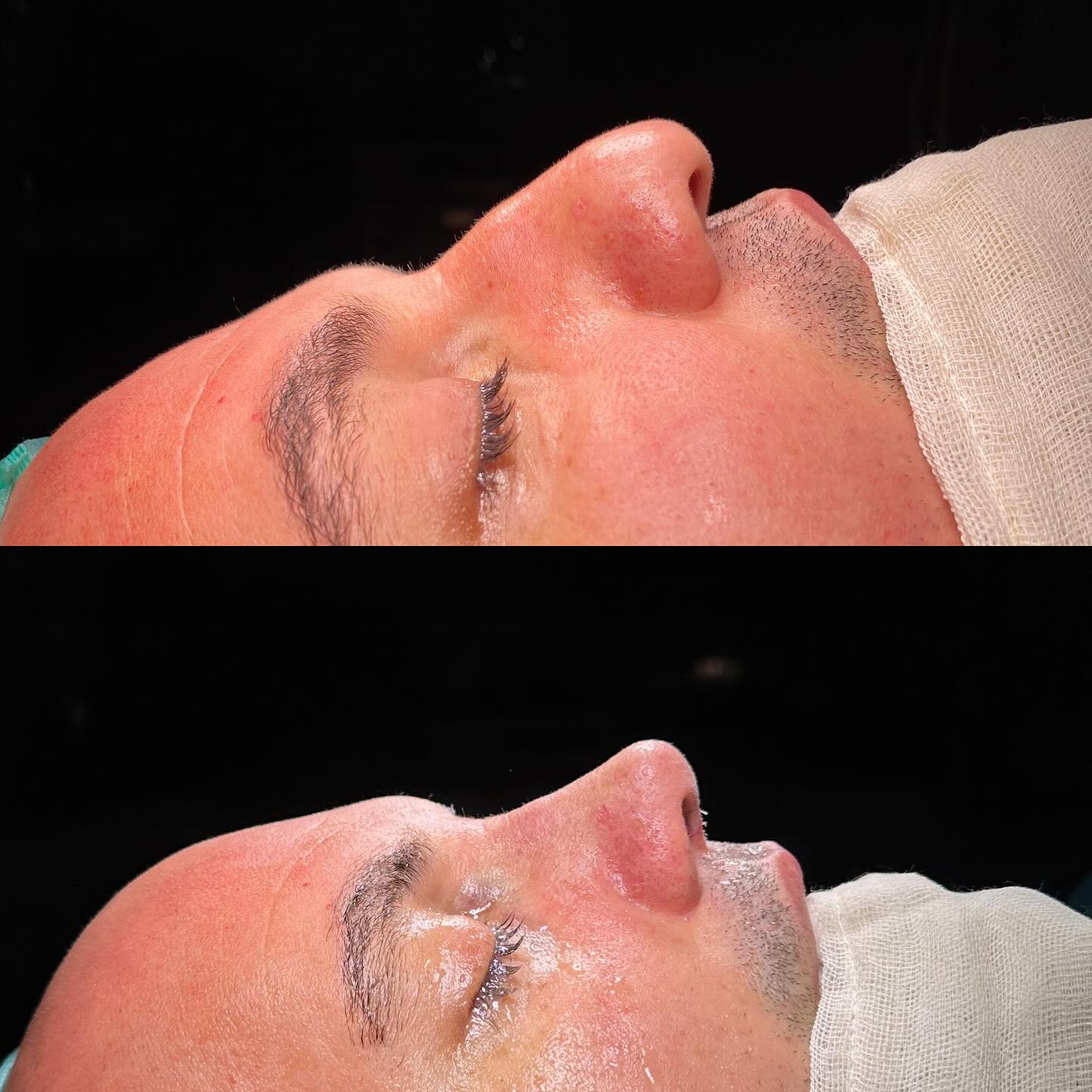 before-after
