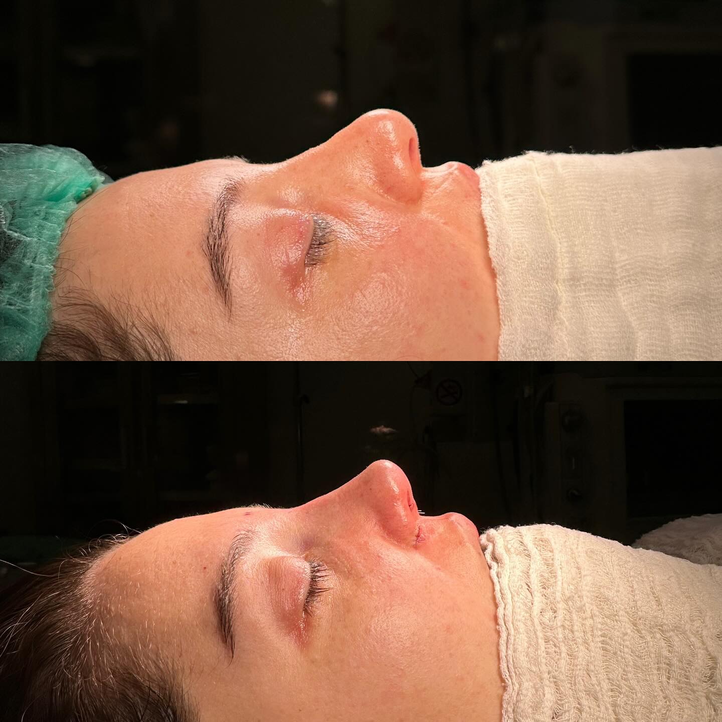 before-after