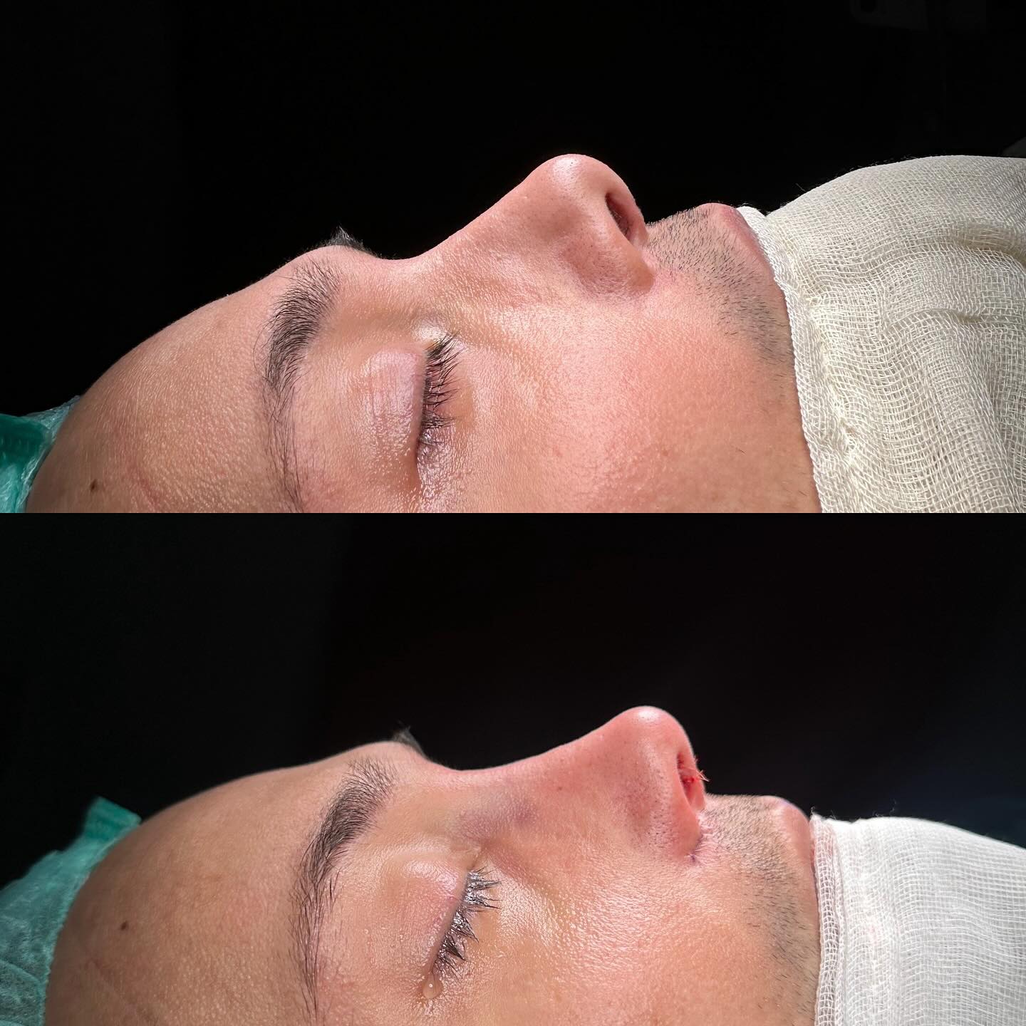 before-after