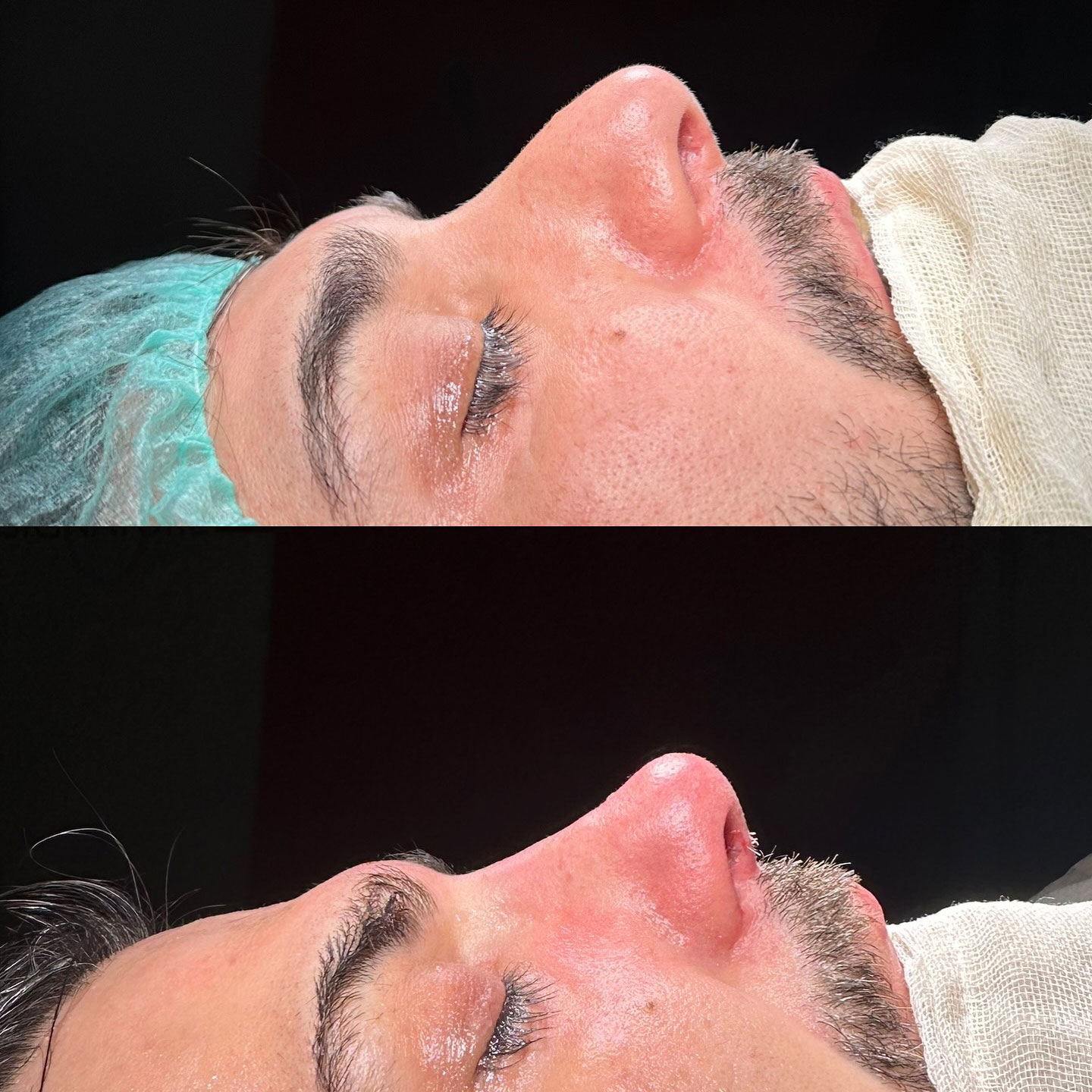 before-after