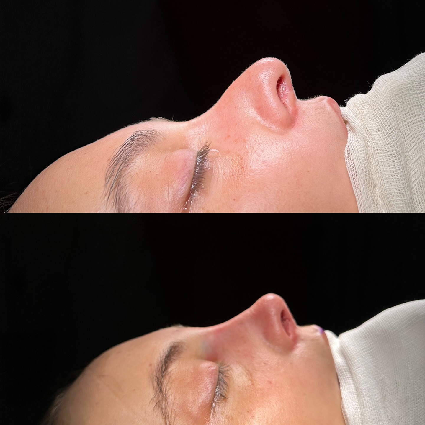 before-after