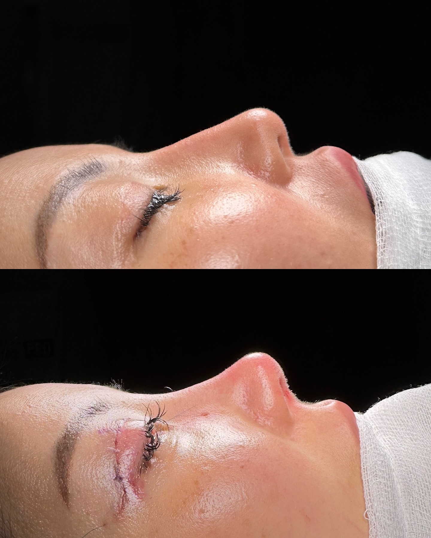 before-after