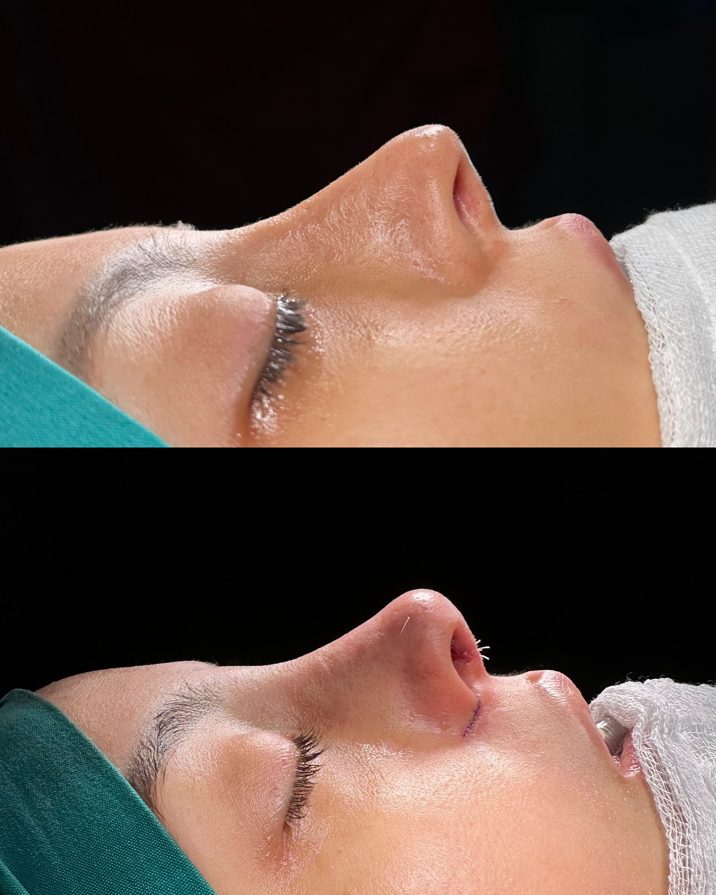 before-after