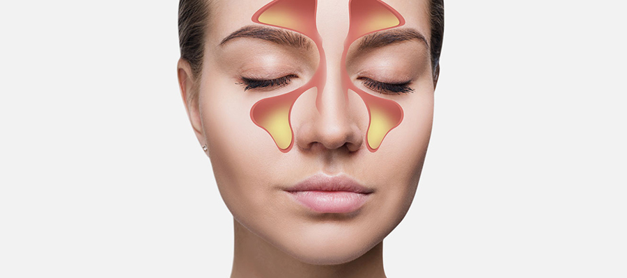 Balonska Sinoplastika