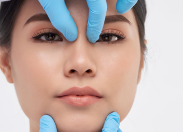 Kada Nestaju Otekline Nakon Operacije Nosa?