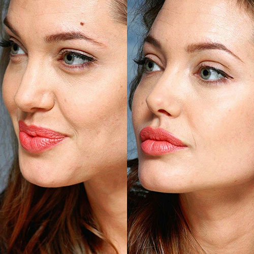 Poznate Ličnosti Koje Su Imale Rinoplastiku 13 angelina jolie burun estetigi
