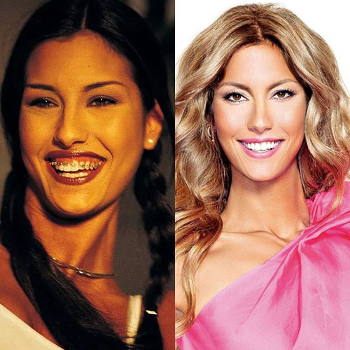 Poznate Ličnosti Koje Su Imale Rinoplastiku 8 cagla sikel burun estetigi