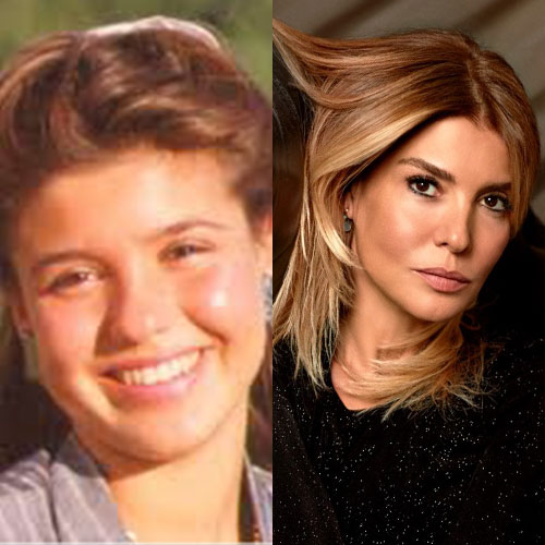 Poznate Ličnosti Koje Su Imale Rinoplastiku 6 gulben ergen burun estetigi