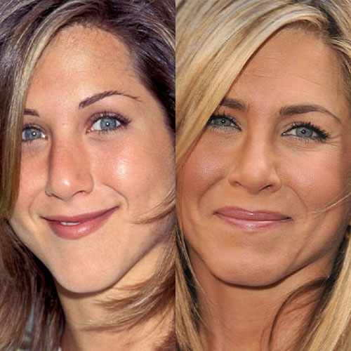 Poznate Ličnosti Koje Su Imale Rinoplastiku 10 jennifer aniston burun estetigi