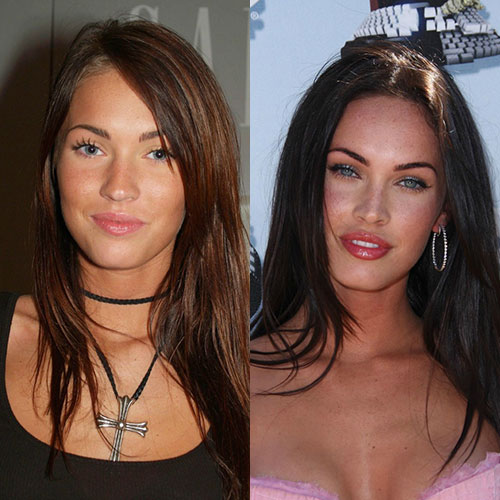 Poznate Ličnosti Koje Su Imale Rinoplastiku 15 megan fox burun estetigi