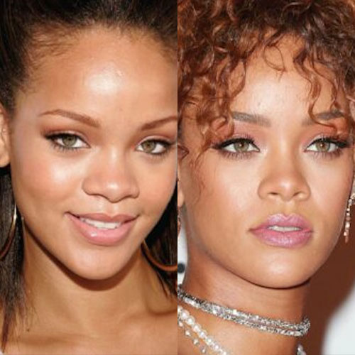 Poznate Ličnosti Koje Su Imale Rinoplastiku 17 rihanna burun estetigi