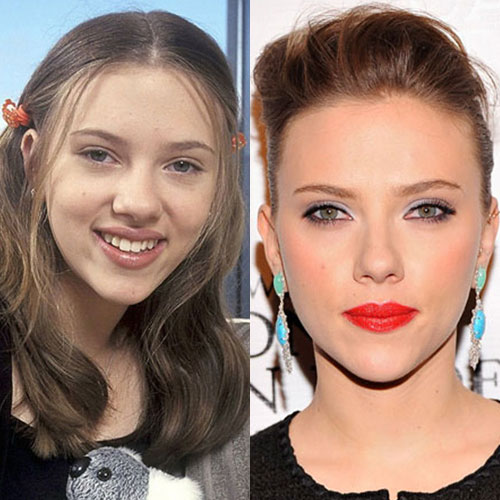 Poznate Ličnosti Koje Su Imale Rinoplastiku 14 scarlet johansson burun estetigi