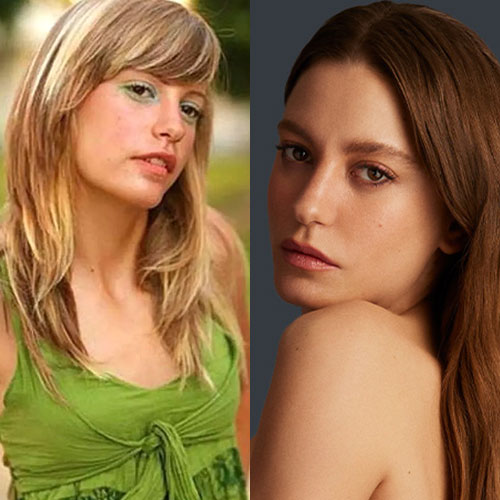 Poznate Ličnosti Koje Su Imale Rinoplastiku 4 serenay sarikaya burun estetigi