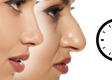 Burun Estetiği Ameliyatı Kaç Saat Sürer?