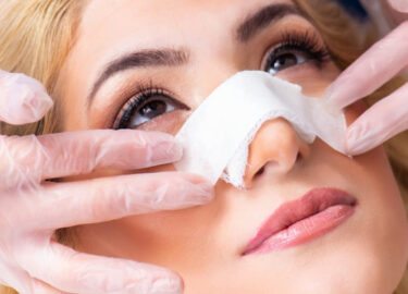 Burun Ameliyatı Sonrası Ödem