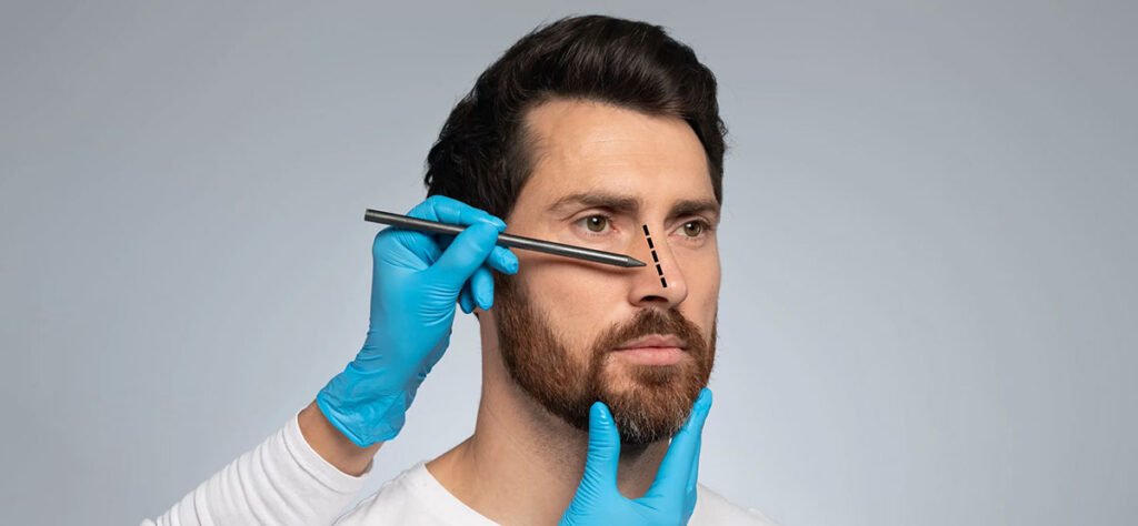 Erkeklerde Dogal Burun Estetigi